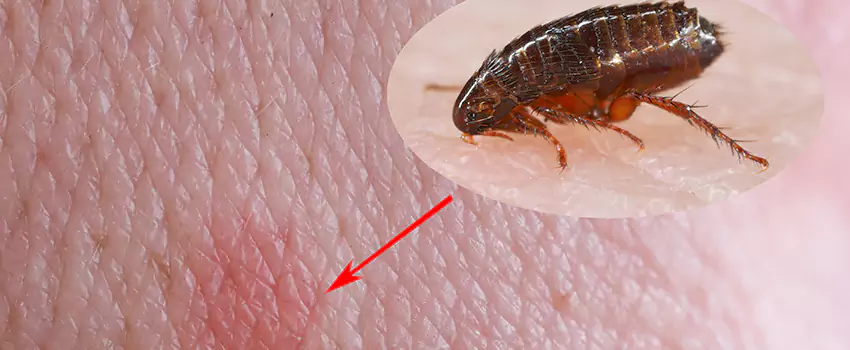 Flea Control for Humans Alpharetta, GA